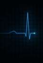 Heartbeat